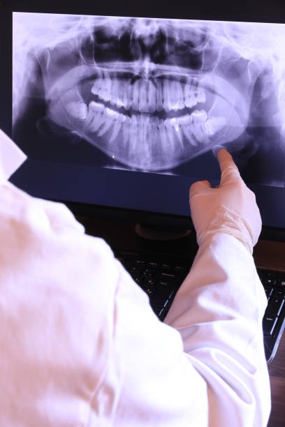 Best Emergency Dental Extractions in Stratford Downtown, CT